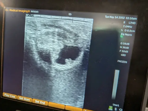 Ultrasound diagnostic imaging display showing medical scan results from dental practice equipment.